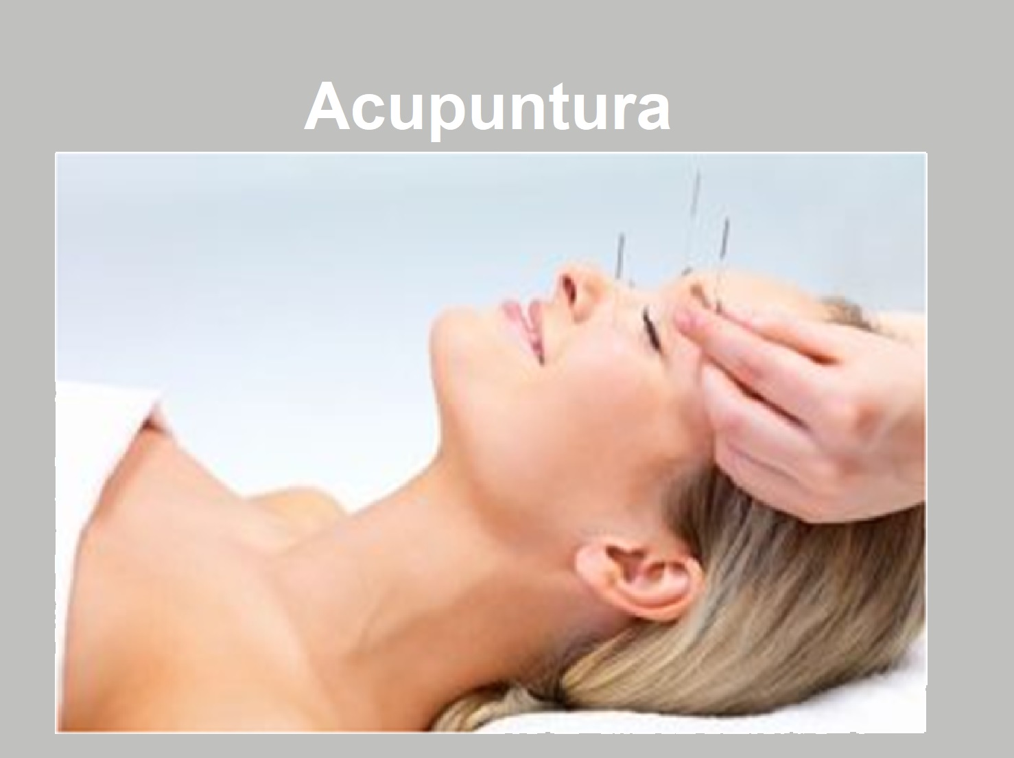 Acupuntura.jpg